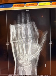 Contusion y Hematoma 3.JPG (3034448 bytes)